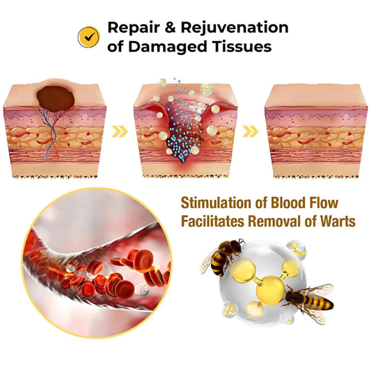 Derma Smooth Skin Tag Removal Patch | Secret To Spotless Skin